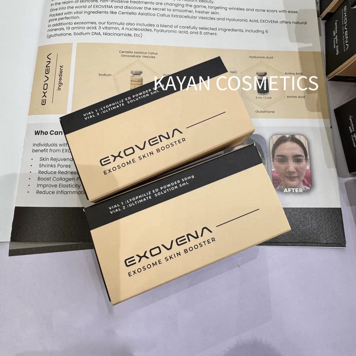 包順豐 韓國 EXOVENA 外泌體水光膠原抗氧老細毛孔收縮微針精華凍乾安瓶EXOVEN EXOSOME SKIN BOOSTER