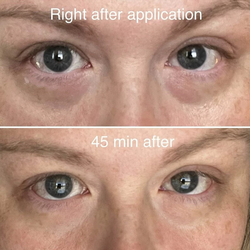 包順豐 德國 AE PLASTISCHE CHIRURGIE AE提亮重塑眼霜 30g淡化皺紋黑眼圈眼袋提拉緊致抗衰 Remodelling Eye Cream