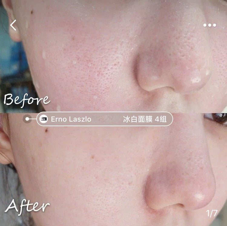 包順豐 Erno Laszlo 奧倫納素 水療再生冰白面膜 冰白面膜一盒4組 vitality treatment mask（STEP 1 ：4x37 ml + STEP 2 ：4×5.5g）