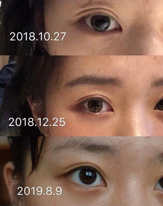 10支=20ml 包順豐 資生堂 Shiseido ELIXIR 怡麗絲爾 抗皺精華眼霜 Elixir 抗衰老防老化 抗皺ELIXIR enriched wrinkle cream A醇抗皱眼霜2g黑眼圈