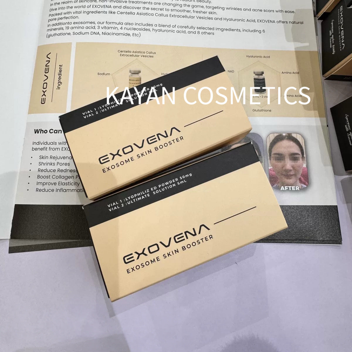 包順豐 韓國 EXOVENA 外泌體水光膠原抗氧K老細毛孔收縮微針精華凍乾安瓶EXOVENA EXOSOME SKIN BOOSTER